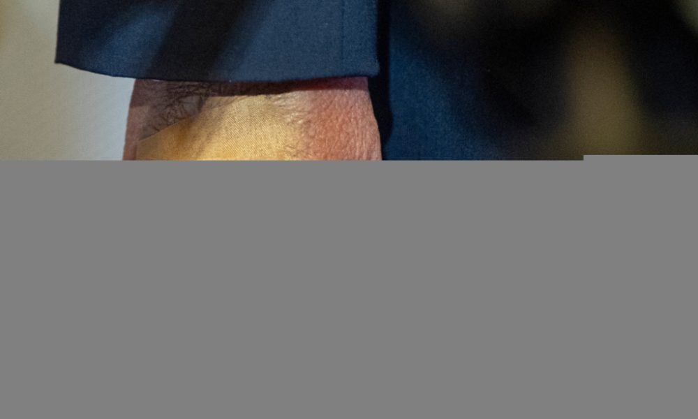 L'ecchymose à la main de Trump due à un choc contre une table