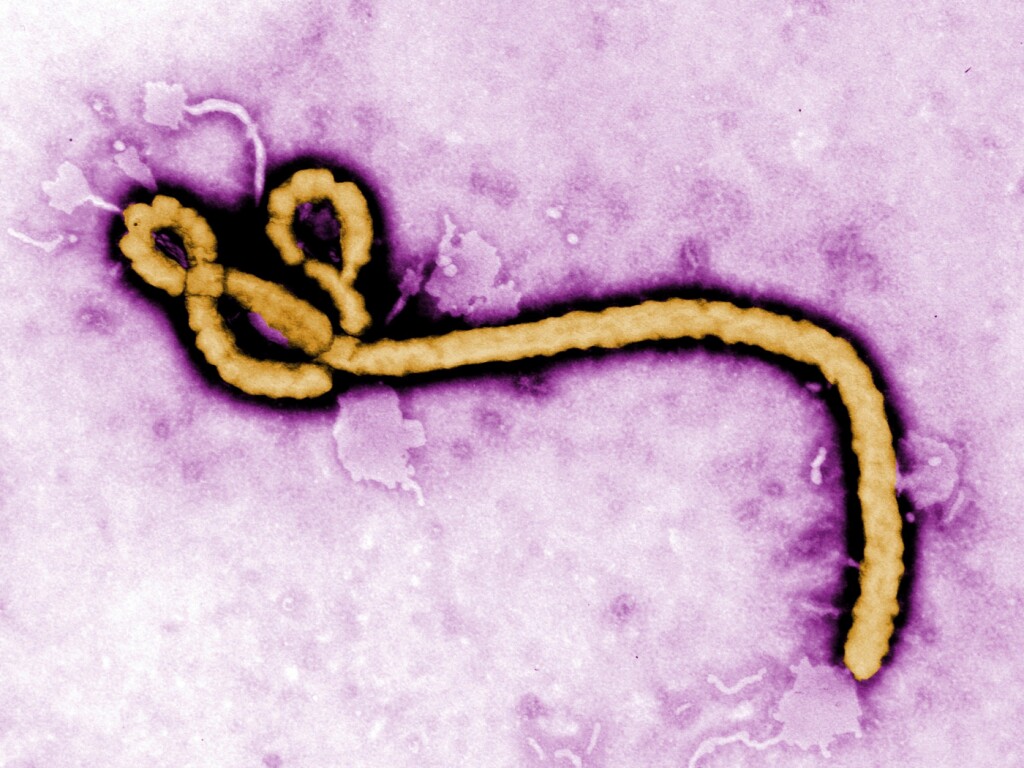 Ebola outbreak: WHO declares an international health emergency | LFM radio
